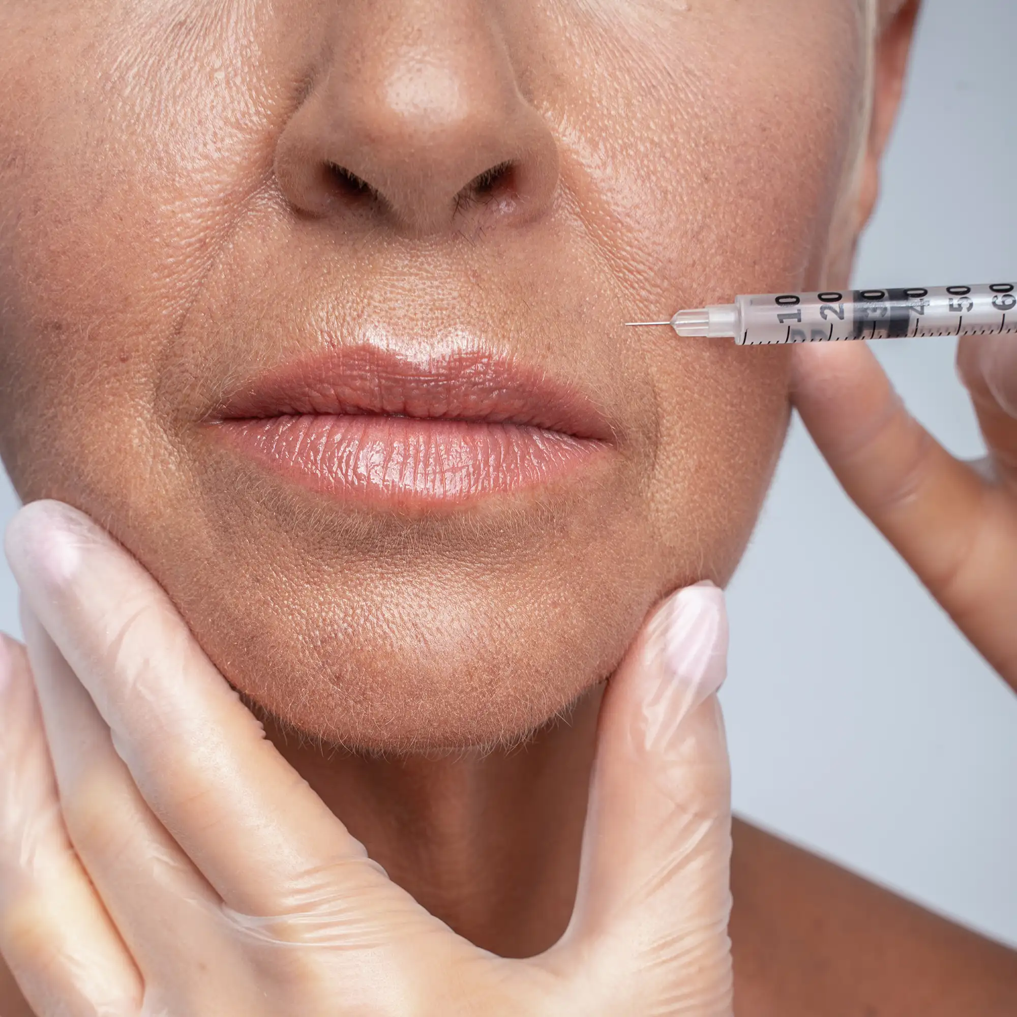 attrezzatura sterile signora anziana mentre si leviga le rughe