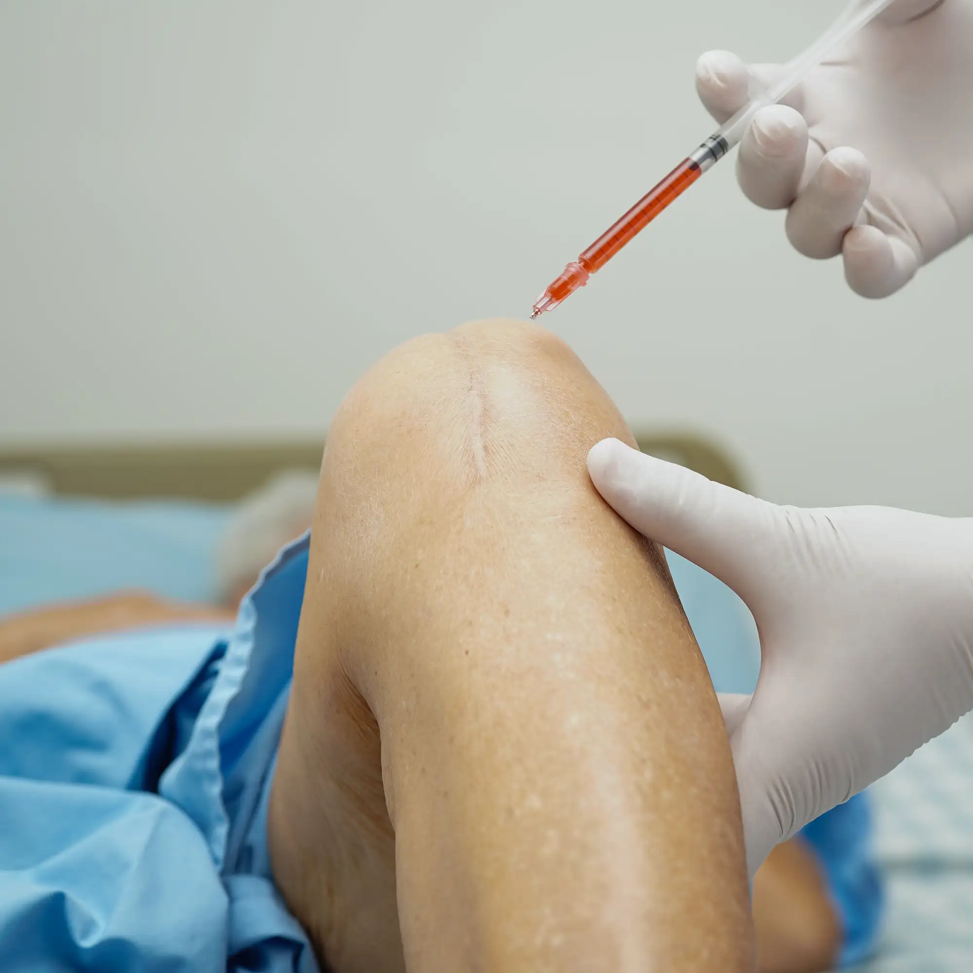 Infiltrazione articolare